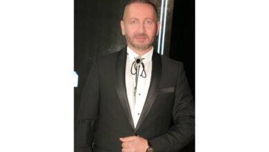 صورة توضيحية - دكتور التجميل Ali AbedAli يتطرق الى عملية حقن الدهون الذاتية في اليدين