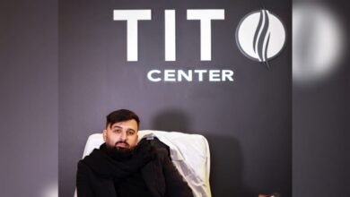 صورة توضيحية - Tito center بصمة واضحة في مجال زراعة الشعر