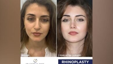 عملية تجميل الأنف/Rhinoplasty.. مع جورج زيادة